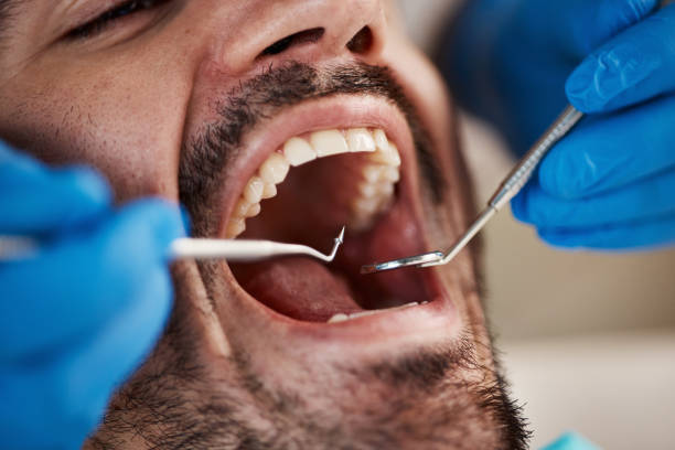 Best Emergency Dental Extractions in Loudonville, OH